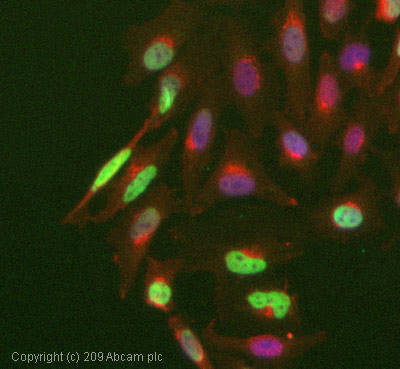 ICC/IF image of ab58548 stained HeLa cells. The cells were 4% PFA fixed (10 min) and then incubated in 1%BSA / 10% normal goat serum / 0.3M glycine in 0.1% PBS-Tween for 1h to permeabilise the cells and block non-specific protein-protein interactions. The cells were then incubated with the antibody (ab58548, 1µg/ml) overnight at +4°C. The secondary antibody (green) was Alexa Fluor® 488 goat anti-rabbit IgG (H+L) used at a 1/1000 dilution for 1h. Alexa Fluor® 594 WGA was used to label plasma membranes (red) at a 1/200 dilution for 1h. DAPI was used to stain the cell nuclei (blue) at a concentration of 1.43µM.