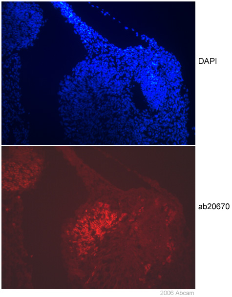 ab20670 detected Islet 1 in the nucleus of frozen sections of E11.5 mouse embryonic brain using 1 ug/ml of antibody. Brighter staining may be achieved using a greater concentration of antibody, e.g. 2.5 or 5 ug/ml. 