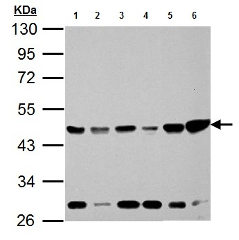 All lanes : Anti-Isocitrate dehydrogenase antibody (ab154932) at 1/10000 dilutionLane 1 : Neuro2A whole cell lysateLane 2 : GL261 whole cell lysateLane 3 : C8D30 whole cell lysateLane 4 : NIH 3T3 whole cell lysateLane 5 : Raw 264.7 whole cell lysateLane 6 : C2C12 whole cell lysateLysates/proteins at 30 µg per lane.