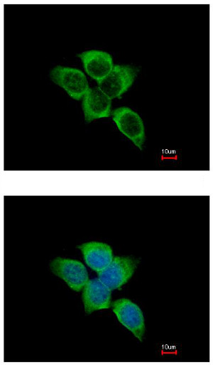 Immunofluorescent analysis of methanol-fixed A431 cells labeling Isocitrate dehydrogenase using ab154932 at 1/500 (upper image) and costained with Hoechst 33342 (lower image).