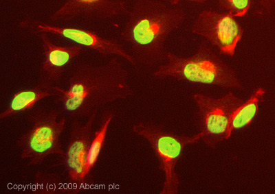 ICC/IF image of ab47816 stained HeLa cells. The cells were 4% PFA fixed (10 min) and then incubated in 1%BSA / 10% normal Goat serum / 0.3M glycine in 0.1% PBS-Tween for 1h to permeabilise the cells and block non-specific protein-protein interactions. The cells were then incubated with the antibody (ab47816, 5µg/ml) overnight at +4°C. The secondary antibody (green) was Alexa Fluor® 488 Goat anti-Rabbit IgG (H+L) used at a 1/1000 dilution for 1h. Alexa Fluor® 594 WGA was used to label plasma membranes (red) at a 1/200 dilution for 1h. DAPI was used to stain the cell nuclei (blue) at a concentration of 1.43µM. This antibody also gave a positive result in 4% PFA fixed (10 min) Hek293, HepG2, and MCF-7 cells at 5µg/ml, and in 100% Methanol fixed (5 min) HeLa, Hek293, HepG2, and MCF-7 cells at 5µg/ml.