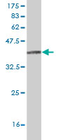 Western blot against tagged recombinant protein immunogen using ab56355 ITGA8 antibody at 1ug/ml.