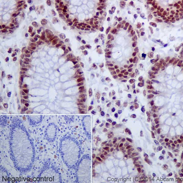 Immunohistochemical analysis of paraffin-embedded Human colon tissue labeling Histone H2A (acetyl K9) with ab177312 at 1/4000 dilution, followed by Goat Anti-Rabbit IgG H&L (HRP) (ab97051) secondary antibody at 1/500 dilution. Nucleus staining on Human colon tissue is observed. Counter stained with Hematoxylin.Negative control: Used PBS instead of primary antibody, secondary antibody is Goat Anti-Rabbit IgG H&L (HRP) (ab97051) at 1/500 dilution.
