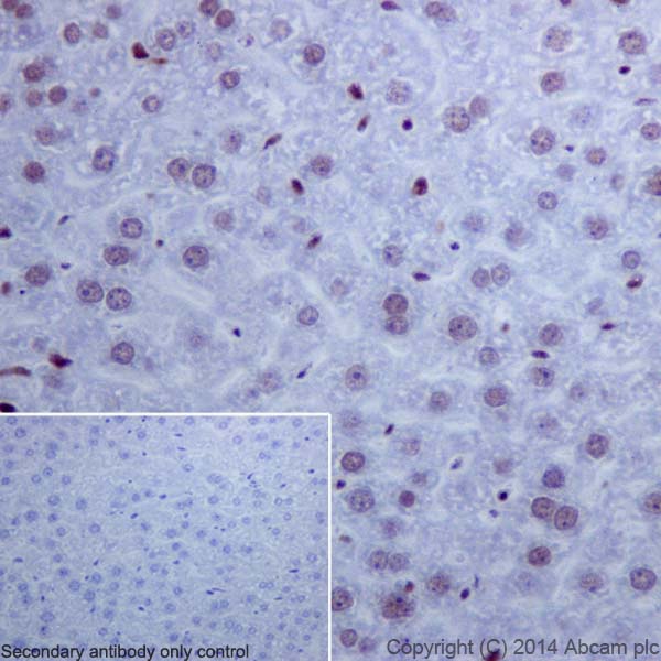 Immunohistochemical analysis of paraffin-embedded mouse liver tissue labeling Histone H2A (acetyl K9) with ab177312 at 1/4000 dilution, followed by Goat Anti-Rabbit IgG H&L (HRP) (ab97051) secondary antibody at 1/500 dilution. Nucleus staining on mouse liver tissue is observed. Counter stained with Hematoxylin.Negative control: Used PBS instead of primary antibody, secondary antibody is Goat Anti-Rabbit IgG H&L (HRP) (ab97051) at 1/500 dilution.
