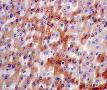 Immunohistochemical analysis of paraffin-embedded Human liver tissue labeling ITIH4 with ab180139 at 1/500 dilution. Secondary antibody Goat anti rabbit IgG(HRP) prediluted. Counter stain Hematoxylin.