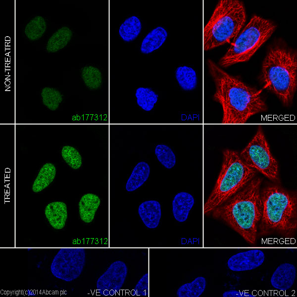 Immunofluorescent analysis of 4% paraformaldehyde-fixed, 0.1% Triton X-100 permeabilized HeLa (Human epithelial cells from cervix adenocarcinoma) cells, untreated and treated with Trichostatin A (500 ng/ml) for 4 hours, labeling Histone H2A (acetyl K9) with ab177312 at 1/2000 dilution, followed by Goat anti-rabbit IgG (Alexa Fluor® 488) (ab150077) secondary antibody at 1/500 dilution (green). Confocal image showing nuclear staining on HeLa cell line. Acetylation level increased after treatment with Trichostatin A (500 ng/ml) for 4 hours. The nuclear counter stain is DAPI (blue). Tubulin is detected with ab7291 (anti-Tubulin mouse mAb) at 1/1000 dilution and ab150120 (AlexaFluor®594 Goat anti-Mouse secondary) at 1/500 dilution (red).The negative controls are as follows:-ve control 1: ab177312 at 1/2000 dilution followed by ab150120 (AlexaFluor®594 Goat anti-Mouse secondary) at 1/500 dilution.-ve control 2: ab7291 (anti-Tubulin mouse mAb) at 1/1000 dilution followed by ab150077 (Alexa Fl