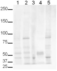 Western blot for Jagged 2 antibody (ab10556) at 1/500 tested on the following tissue lysates:Lane 1: Mouse BrainLane 2: Mouse LungLane 3: Rat BrainLane 4: Rat LungLane 5: Mouse Brain Day 0Secondary ab: Goat anti-rabbit IgG ab6721 (1/5000)Exposure time: 10 minutesExpected molecular weight: 130 kDaCell lysates at 20µg per lane.NB: This image shows that is was not possible to detect Jagged 2 by WB in the lysates tested. This maybe due to low expression/abundance of Jagged 2 compounded by the fact that Jagged 2 expression is developmentally regulated and induced making it difficult to detect in whole tissue homogenates. In favour of the Jagged 2 antibody (ab10556), this WB shows relatively low background and minimal cross reactivity in tissue lysate.