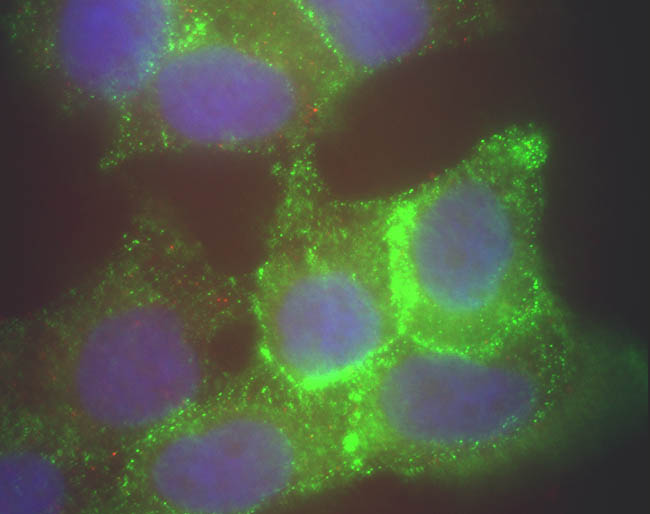 Staining of Human corneal epithelial cells with anti-Jagged1 (ab7771, 1/500). The Jagged1 (green staining) is localised to the cytoplasm and cell nucleus and is consistent with reports in the literature. The nucleus is stained with Bis benzimide (1/500, blue staining).