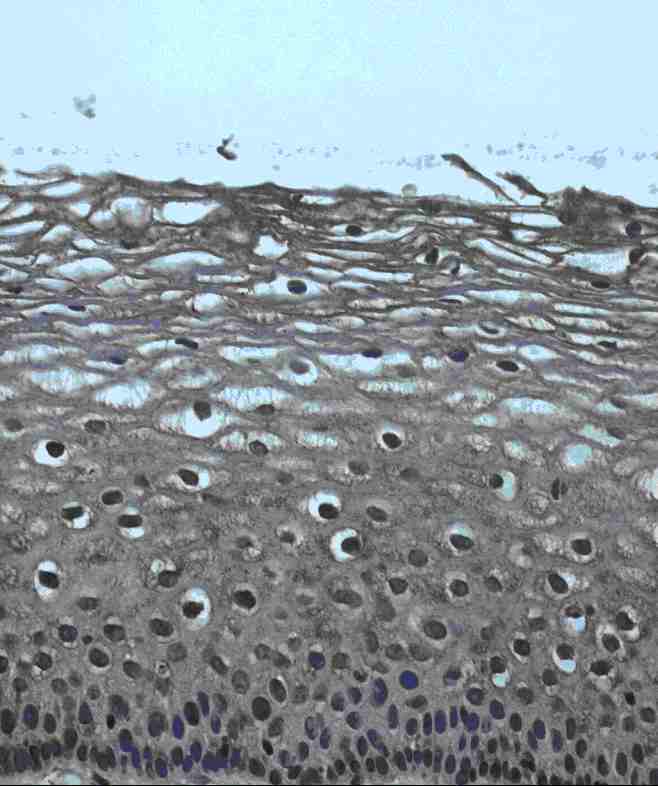 Formalin-fixed paraffin embedded IHC of normal human cervial tissues (40x magnification) stained with ab7771 (1/100 dilution). The slides were counterstained with hematoxylin 