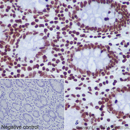 Immunohistochemical analysis of paraffin-embedded Human colon tissue labeling Histone H2A (mono methyl K118) with ab177387 at 1/2000 dilution, followed by Goat Anti-Rabbit IgG H&L (HRP) (ab97051) secondary antibody at 1/500 dilution. Nucleus staining on glandular epithelium of human colon tissue is observed. Counter stained with Hematoxylin.Negative control: Using PBS instead of primary antibody, secondary antibody is Goat Anti-Rabbit IgG H&L (HRP) (ab97051) at 1/500 dilution.