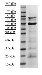 Anti-JAK2 (phospho Y1007 + Y1008) antibody (ab68268) at 1/500 dilution + GH stimulated mouse liver tissue lysate