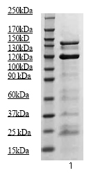 Anti-JAK2 (phospho Y1007 + Y1008) antibody (Biotin) (ab68270) at 1/500 dilution + GH stimulated mouse liver tissue lysate