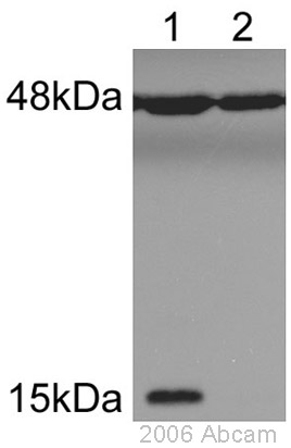 All lanes : Anti-Histone H2A (phospho S1) + Histone H4 (phospho S1) antibody (ab14723) at 1/1000 dilutionLane 1 : YDH8 cka 2-8 ts grown at 30 degrees CLane 2 : YDH8 cka 2-8 ts grown at 38 degrees CSecondaryHRP conjugated anti-Rabbit