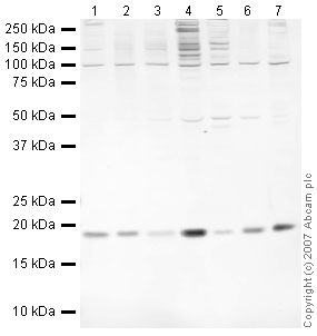 All lanes : Anti-JDP2 antibody (ab40916) at 1 µg/mlLane 1 : HeLa (Human epithelial carcinoma cell line) Whole Cell Lysate Lane 2 : HeLa (Human epithelial carcinoma cell line) Nuclear LysateLane 3 : Jurkat (Human T cell lymphoblast-like cell line) Whole Cell Lysate Lane 4 : Jurkat (Human T cell lymphoblast-like cell line) Nuclear Lysate (ab14844)Lane 5 : HepG2 (Human hepatocellular liver carcinoma cell line) Nuclear Lysate (ab14660)Lane 6 : Du145 (Human prostate carcinoma cell line) Whole Cell Lysate Lane 7 : LNCaP (Human prostate adenocarcinoma cell line) Nuclear lysateLysates/proteins at 10 µg per lane.SecondaryIRDye 680 Conjugated Goat Anti-Rabbit IgG (H+L) at 1/10000 dilutionPerformed under reducing conditions.
