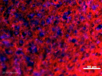 ab65211 staining the JIP2 (Red) in Zebra finch basal ganglia (striatum) tissue sections by Immunohistochemistry (IHC-Fr - frozen sections). Tissue was fixed with paraformaldehyde, permeabilized with TBS + 0.3% Triton and blocked with 5% serum for 1 hour at 25°C. Samples were incubated with primary antibody (1/50 in PBS Tween) for 24 hours at 4°C. An Alexa Fluor®555-conjugated goat anti-rabbit IgG polyclonal (1/1000) was used as the secondary antibody. Nuclei were stained with DAPI (Blue). See Abreview