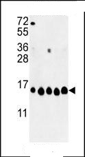 All lanes : Anti-Histone H2A antibody (ab93460) at 1/1000 dilutionLane 1 : A2058Lane 2 : A375Lane 3 : K562Lane 4 : HeLaLane 5 : MCF-7Lysates/proteins at 35 µg per lane.