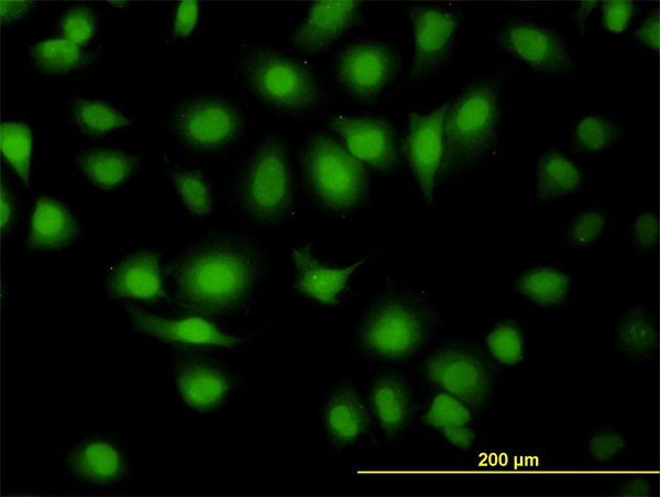 ab88076 at 10µg/ml staining JNK2 in Hela cells.