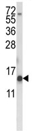 Anti-Histone H2A antibody (ab93460) at 1/100 dilution + K562 cell line lysates at 35 µg