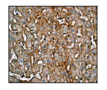 Immunohistochemical staining of paraffin-embedded human liver using ab52647 at a 1/100 dilution.