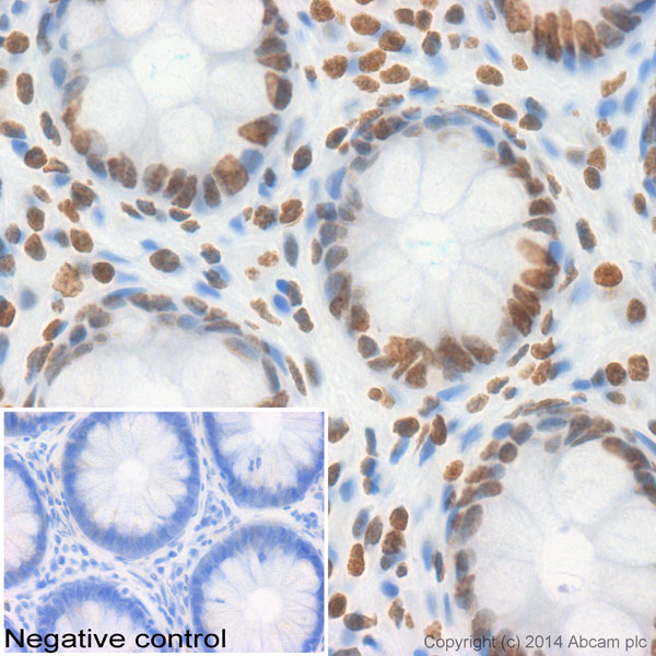 IHC image of ab116553 staining Histone H2A in human colon formalin fixed paraffin embedded tissue sections, performed on a Leica Bond. The section was pre-treated using heat mediated antigen retrieval with sodium citrate buffer (pH6, epitope retrieval solution 1) for 20 mins. The section was then incubated with ab116553, 5µg/ml, for 15 mins at room temperature and detected using an HRP conjugated compact polymer system. DAB was used as the chromogen. The section was then counterstained with haematoxylin and mounted with DPX. No primary antibody was used in the negative control (shown on the inset). For other IHC staining systems (automated and non-automated) customers should optimize variable parameters such as antigen retrieval conditions, primary antibody concentration and antibody incubation times.