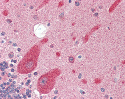 ab115472 at 5ug/ml staining KA1 in Formalin-fixed, Paraffin-embedded Human brain (cerebellum) tissue by Immunohistochemistry, followed by biotinylated secondary antibody, alkaline phosphatase-streptavidin and chromogen.