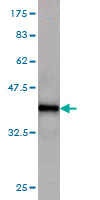 Western blot against tagged recombinant protein immunogen using ab55266 KAL1 antibody at 1ug/ml.