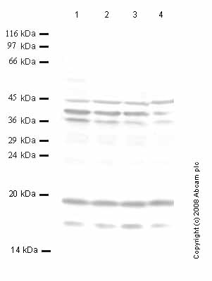 All lanes : Anti-Kallikrein 9 antibody - Catalytic domain (ab40955) at 1/1000 dilutionLane 1 : Whole cell lysate prepared from A2058 human melanoma cancer cells (treated with SF) Lane 2 : Whole cell lysate prepared from A2058 human melanoma cancer cells (treated with TPA) Lane 3 : Whole cell lysate prepared from A2058 human melanoma cancer cells (treated with IL1-alpha) Lane 4 : Whole cell lysate prepared from A2058 human melanoma cancer cells (treated with TNF-alpha) Lysates/proteins at 5 µl per lane.
