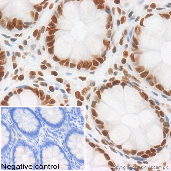 IHC image of ab116677 staining Histone H2A in human colon formalin fixed paraffin embedded tissue sections, performed on a Leica Bond. The section was pre-treated using heat mediated antigen retrieval with sodium citrate buffer (pH6, epitope retrieval solution 1) for 20 mins. The section was then incubated with ab116677, 5µg/ml, for 15 mins at room temperature and detected using an HRP conjugated compact polymer system. DAB was used as the chromogen. The section was then counterstained with haematoxylin and mounted with DPX. No primary antibody was used in the negative control (shown on the inset). For other IHC staining systems (automated and non-automated) customers should optimize variable parameters such as antigen retrieval conditions, primary antibody concentration and antibody incubation times.
