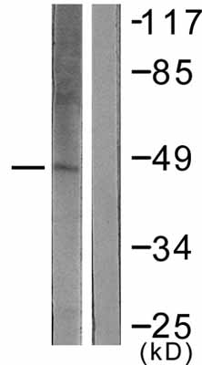 All lanes : Anti-KAT1 / HAT1 antibody (ab61225) at 1/500 dilutionLane 1 : extracts from LOVO cellsLane 2 : extracts from LOVO cells with immunizing peptide