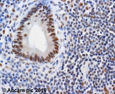 ab84 (2µg/ml) staining SRC1 in human colonic mucosa using an automated system (DAKO Autostainer Plus). Using this protocol there is strong nuclear staining of mucosal epithelium and lymphocytes.Sections were rehydrated and antigen retrieved with the Dako 3 in 1 AR buffer EDTA pH 9.0 in a DAKO PT link. Slides were peroxidase blocked in 3% H2O2 in methanol for 10 mins. They were then blocked with Dako Protein block for 10 minutes (containing casein 0.25% in PBS) then incubated with primary antibody for 20 min and detected with Dako envision flex amplification kit for 30 minutes. Colorimetric detection was completed with Diaminobenzidine for 5 minutes. Slides were counterstained with Haematoxylin and coverslipped under DePeX. Please note that, for manual staining, optimization of primary antibody concentration and incubation time is recommended. Signal amplification may be required.