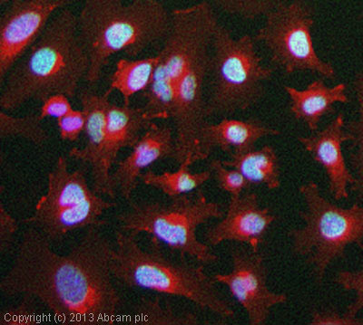 ICC/IF image of ab129217 stained HeLa cells. The cells were exposed to 2000µJ/cm2 of UV, incubated at 37˚C for a further 24 hours. The cells were then 100% methanol fixed (5 min) and then incubated in 1%BSA / 10% normal goat serum / 0.3M glycine in 0.1% PBS-Tween for 1h to permeabilise the cells and block non-specific protein-protein interactions. The cells were then incubated with the antibody (ab129217, 1µg/ml) overnight at +4°C. The secondary antibody (green) was ab96899, DyLight® 488 goat anti-rabbit IgG (H+L) used at a 1/250 dilution for 1h. Alexa Fluor® 594 WGA was used to label plasma membranes (red) at a 1/200 dilution for 1h. DAPI was used to stain the cell nuclei (blue) at a concentration of 1.43µM.
