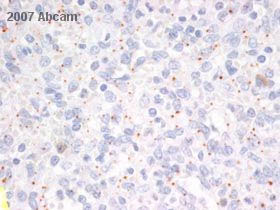 ab18381 at 2ug/ml staining human spleen tissue sections by Immunohistochemistry (Formalin/PFA-fixed paraffin-embedded sections). The tissue was fixed and blocked and incubated with the antibody for 30 minutes. An HRP conjugated goat antibody was used as the secondary. See Abreview