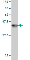 Western blot against tagged recombinant protein immunogen using ab56535 PCAF antibody at 1ug/ml.