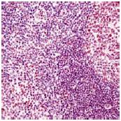ab54327, used neat, staining Human p300 in Tonsil, using Immunohistochemistry, Formalin fixed Paraffin embedded tissue.