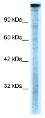 Anti-KAT4 / TBP Associated Factor 1 antibody - ChIP Grade (ab28450) at 0.5 µg/ml + Daudi cell lysate