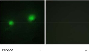 HUVEC cells with ab70183 at 1/500 dilution, with and without the immunising peptide.