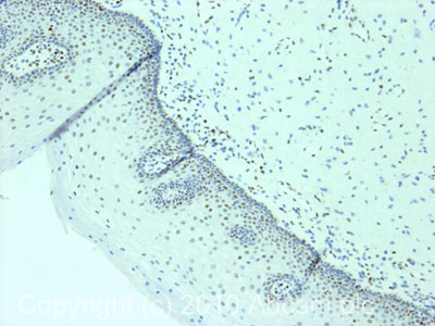IHC image of KAT8/MYST1/MOF staining in human normal cervix formalin fixed paraffin embedded tissue section, performed on a Leica BondTM system using the standard protocol F. The section was pre-treated using heat mediated antigen retrieval with sodium citrate buffer (pH6, epitope retrieval solution 1) for 20 mins. The section was then incubated with ab83502, 5µg/ml, for 15 mins at room temperature and detected using an HRP conjugated compact polymer system. DAB was used as the chromogen. The section was then counterstained with haematoxylin and mounted with DPX.