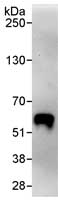 Detection of Human KAT8 / MYST1 / MOF by Immunoprecipitation in Whole cell lysate from HeLa cells (1 mg for IP, 20% of IP loaded) using ab72056 at 3 µg/mg lysate. Subsequent WB detection was done using ab72056 at 1 µg/ml.