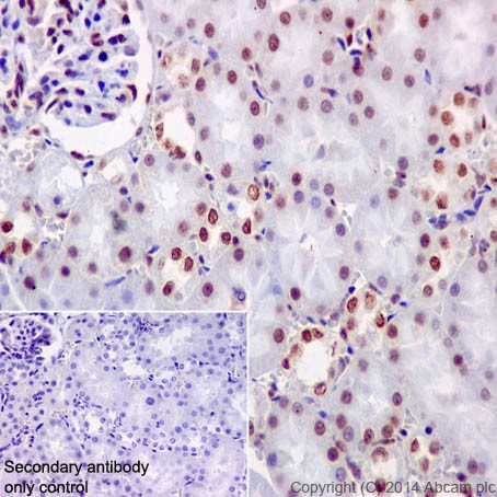 Immunohistochemical analysis of paraffin-embedded Rat kidney tissue labeling KAT8 / MYST1 / MOF with ab200660 at 1/500 dilution, followed by Goat Anti-Rabbit IgG H&L (HRP) (ab97051) secondary antibody at 1/500 dilution.Nuclear staining on rat kidney tissue is observed.Counter stained with Hematoxylin.Secondary antibody only control: Used PBS instead of primary antibody, secondary antibody is Goat Anti-Rabbit IgG H&L (HRP) (ab97051) at 1/500 dilution.