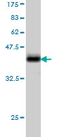 Western blot against tagged recombinant protein immunogen using ab57207 KChIP2 antibody at 1ug/ml.