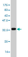 Western blot against tagged recombinant protein immunogen using ab55274 KCNE1 antibody at 1ug/ml.