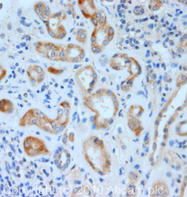 IHC image of KCNE2 staining in human normal kidney formalin fixed paraffin embedded tissue section, performed on a Leica BondTM system using the standard protocol F. The section was pre-treated using heat mediated antigen retrieval with sodium citrate buffer (pH6, epitope retrieval solution 1) for 20 mins. The section was then incubated with ab69376, 5µg/ml, for 15 mins at room temperature and detected using an HRP conjugated compact polymer system. DAB was used as the chromogen. The section was then counterstained with haematoxylin and mounted with DPX.