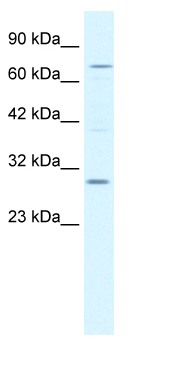 Anti-KCNIP1 antibody (ab66628) at 1.35 µg/ml + Jurkat cell lysate at 10 µgSecondaryHRP conjugated anti-Rabbit IgG at 1/50000 dilution