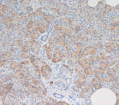 IHC image of KCNJ5 staining in human pancreas formalin fixed paraffin embedded tissue section, performed on a Leica BondTM system using the standard protocol F. The section was pre-treated using heat mediated antigen retrieval with sodium citrate buffer (pH6, epitope retrieval solution 1) for 20 mins. The section was then incubated with ab113699, 1µg/ml, for 15 mins at room temperature and detected using an HRP conjugated compact polymer system. DAB was used as the chromogen. The section was then counterstained with haematoxylin and mounted with DPX. For other IHC staining systems (automated and non-automated) customers should optimize variable parameters such as antigen retrieval conditions, primary antibody concentration and antibody incubation times.