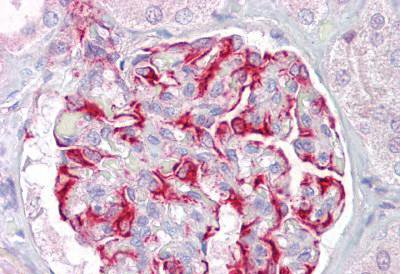 Immunohistochemical analysis of formalin fixed, paraffin-embedded Human kidney tissue labelling KCNK13 with ab133788 at 5 µg/ml. Primary incubation was followed by biotinylated Goat anti-Rabbit IgG secondary antibody, alkaline phosphatase-streptavidin and chromogen.