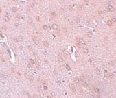 ab106411, at 5 µg/ml, staining KCNK18/TRESK in paraffin embedded Rat brain tissue.