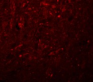 Immunofluorescence of TRESK in Rat Brain cells using ab106411 at 20 ug/ml.