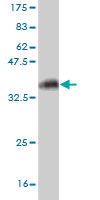 Western blot against tagged recombinant protein immunogen using ab57219 KCNMB3 antibody at 1ug/ml.