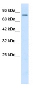 Anti-KCNN3 antibody (ab28631) at 2 µg/ml + Daudi (Human Burkitt’s lymphoma cell line) Whole Cell Lysate 10ug.SecondaryHRP conjugated anti-Rabbit IgG