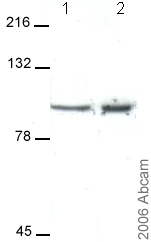 All lanes : Anti-KCNQ2 antibody (ab22897) at 1 µg/mlLane 1 : Rat whole brain lysateLane 2 : Mouse whole brain lysateLysates/proteins at 40 µg per lane.SecondaryAnti-rabbit HRP at 1/20000 dilutiondeveloped using the ECL techniquePerformed under reducing conditions.